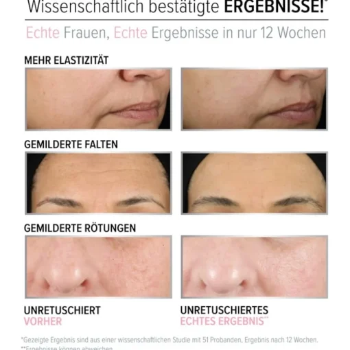 Anti-Aging Daily Retinol Serum-In-Cream von it Cosmetics