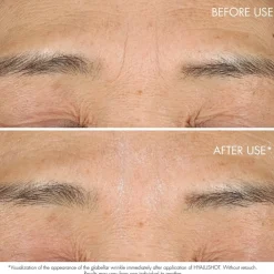 Capture Totale Hyalushot von DIOR