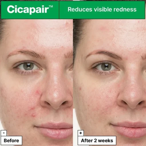 Cicapair So Soothing Treatment von Dr. Jart+