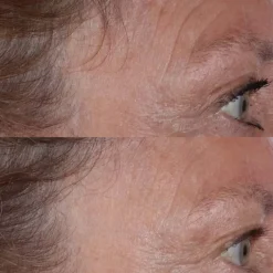 Cold Plasma Plus+ The Essence von Perricone MD