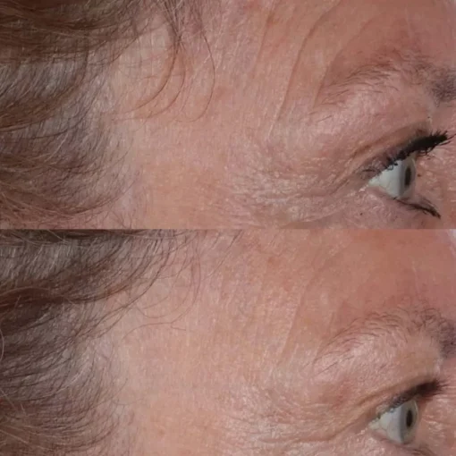 Cold Plasma Plus+ The Essence von Perricone MD