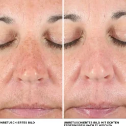 Concealer Bye Bye Dark Spots Concealer von it Cosmetics