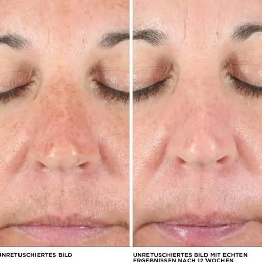 Concealer Bye Bye Dark Spots Concealer von it Cosmetics