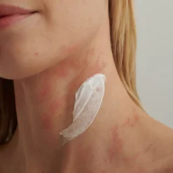 EXTRODERM INTENSIVCREME - bei  trockener Haut und Neurodermitis von DADO SENS