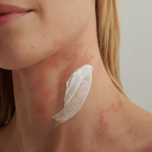 EXTRODERM INTENSIVCREME - bei  trockener Haut und Neurodermitis von DADO SENS