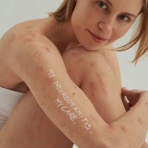 EXTRODERM SHAMPOO - bei trockener Haut und Neurodermitis von DADO SENS