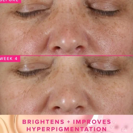 Farmacy Beauty Brighten Up 3% TXA Dark Spot Toner