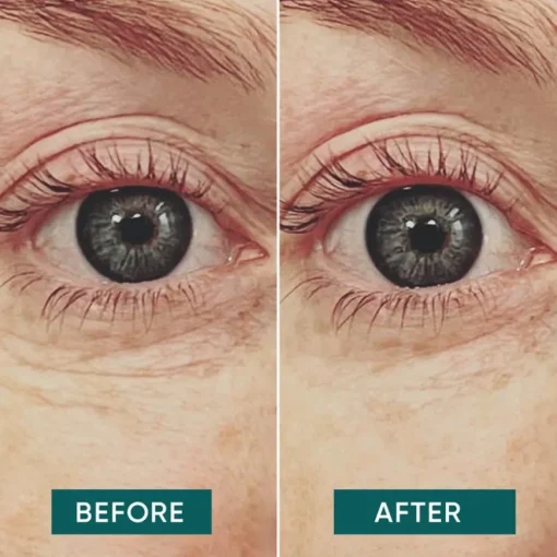 Gesicht Augen Pads mit Vitamin C - glow getter von APRICOT