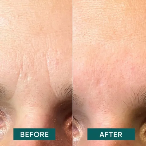 Gesicht Facial Patches Niacinamide - it’s a skin-vestment von APRICOT