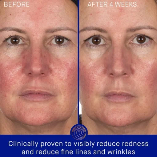 Gesicht Hydrogel Face Mask von Augustinus Bader