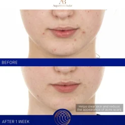 Gesicht The Retinol Serum von Augustinus Bader