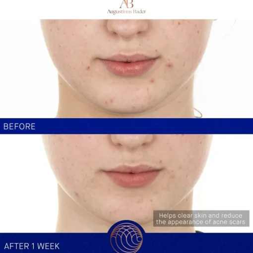 Gesicht The Retinol Serum von Augustinus Bader