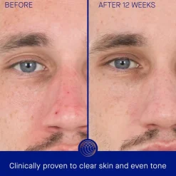 Gesicht The Retinol Serum von Augustinus Bader