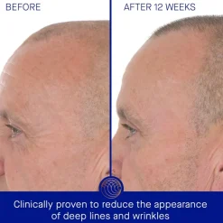 Gesicht The Retinol Serum von Augustinus Bader