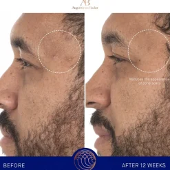 Gesicht The Retinol Serum von Augustinus Bader