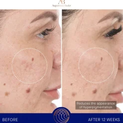 Gesicht The Retinol Serum von Augustinus Bader