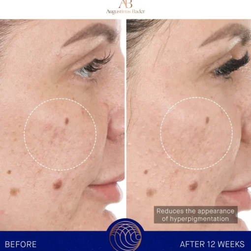 Gesicht The Retinol Serum von Augustinus Bader