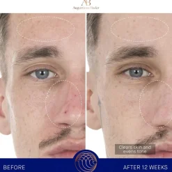Gesicht The Retinol Serum von Augustinus Bader