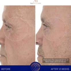 Gesicht The Retinol Serum von Augustinus Bader