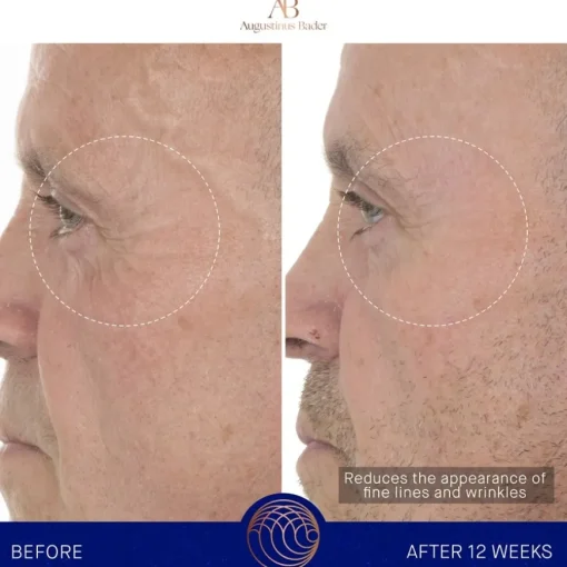 Gesicht The Retinol Serum von Augustinus Bader