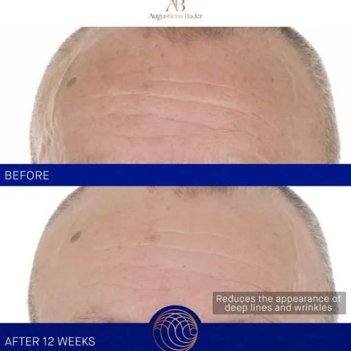 Gesicht The Retinol Serum von Augustinus Bader