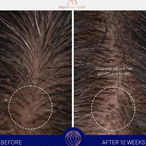 Haare The Conditioner von Augustinus Bader