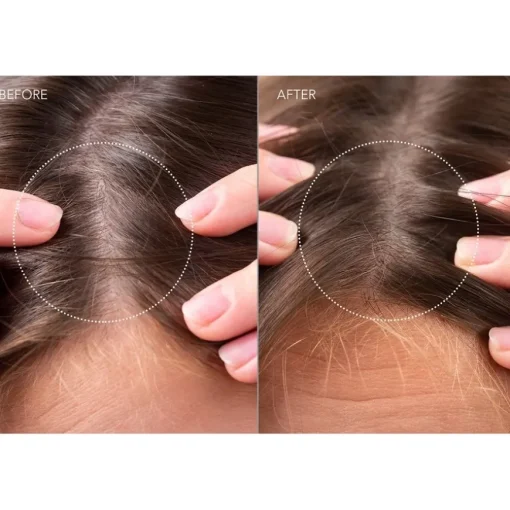 Haarserum Scalp Recovery & Thick Hair Probiotic Serum von FAQ Swiss