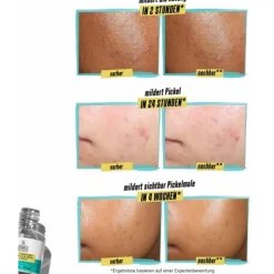 Kiehl's Truly Targeted Blemish Clearing Solution