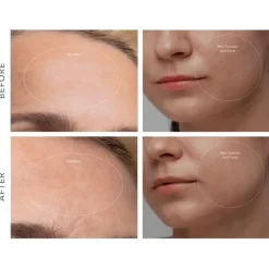 KIWI derma von Foreo