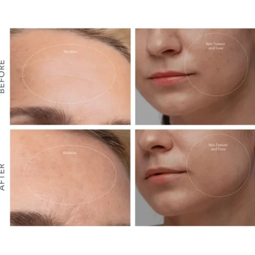 KIWI derma von Foreo