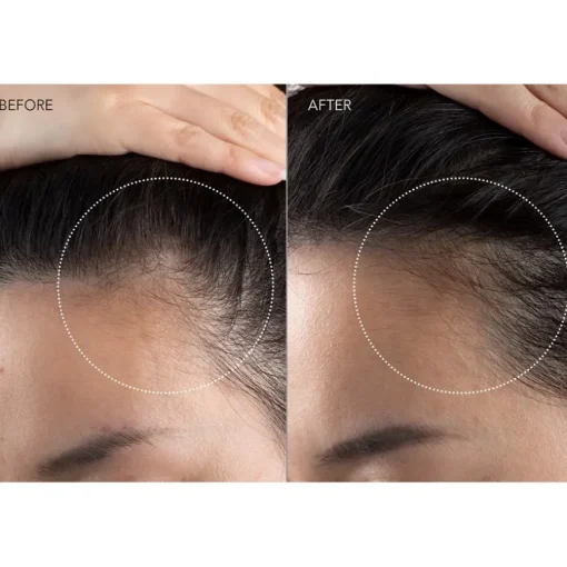 Kopfhautpflege FAQ™ 301 - LED Hair Strengthening Scalp Massager von FAQ Swiss