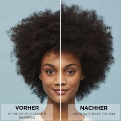 Kopfhautpflege Scalp & Hair Conditioner von Nioxin