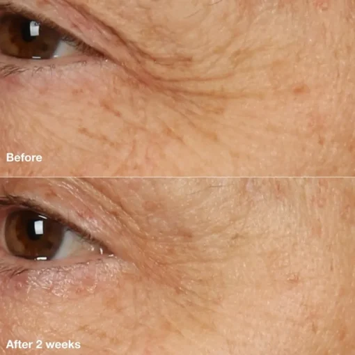 Masken Smart Clinical Repair Overnight Cream & Mask von Clinique