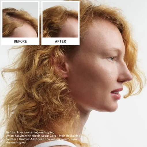 Naturbelassenes, dezent dünner werdendes Haar Cleanser Shampoo Natural Hair Progressed Thinning von Nioxin