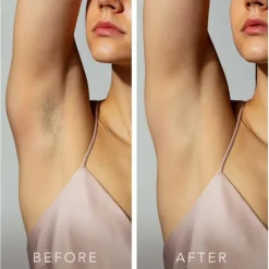 PEACH 2 IPL-Haarentfernungsgerät Mint von Foreo
