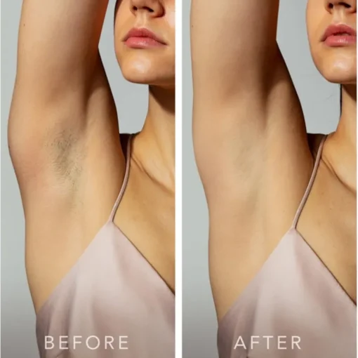 PEACH 2 IPL-Haarentfernungsgerät Mint von Foreo