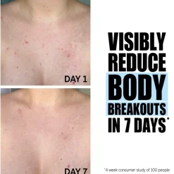 Peeling Glycolic Acid Exfoliating Body Stick von The INKEY List