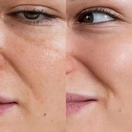 Peeling Skin Exfoliating Peeling von Rosental Organics