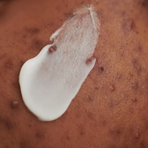 PURDERM WASCHCREME - bei unreiner Haut von DADO SENS