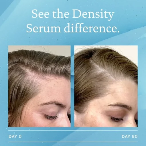 Scalp Care Density Serum von Living Proof