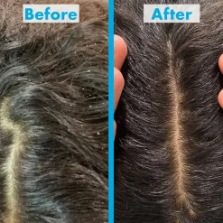 Scalp Restore Scalp Reviving Anti-Dandruff Shampoo von Umberto Giannini