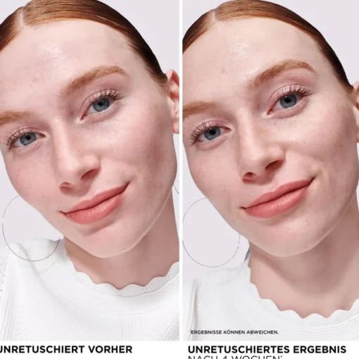 Seren Bye Bye Redness Serum von it Cosmetics