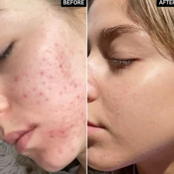 Seren Niacinamide Serum von The INKEY List