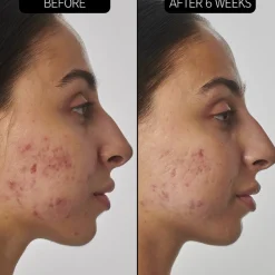 Seren SuperSolutions 1% Retinol Serum von The INKEY List