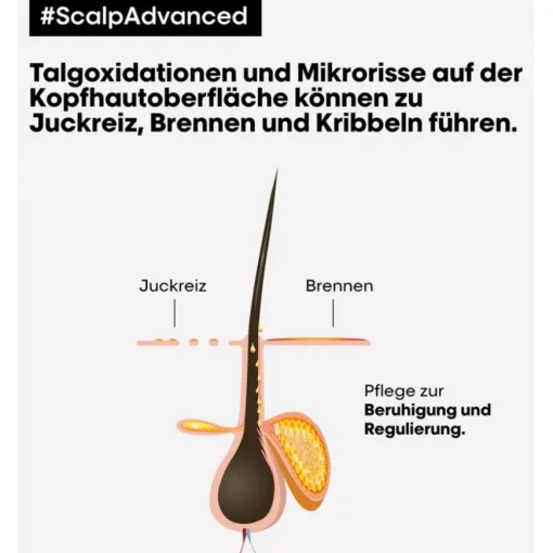 Serie Expert Scalp Advanced Anti-Discomfort Intense Soother Treatment von L’Oréal Professionnel Paris