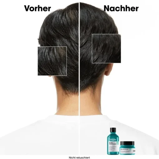 Serie Expert Scalp Advanced Anti-Oiliness 2in1 Deep Purifier Clay von L’Oréal Professionnel Paris