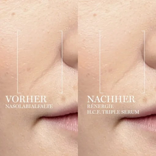 Serum Rénergie H.C.F. Triple Serum von Lancôme