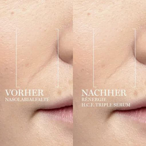 Serum Rénergie H.C.F. Triple Serum von Lancôme
