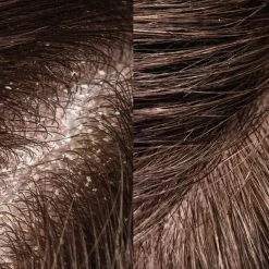 Shampoo Exfoliating Hair Brush von Rosental Organics