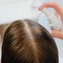 Start Anti-Hair Loss Direct Spray von Revlon Professional